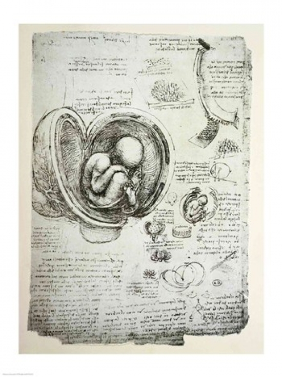 絵画 the memory in the womb C. 1860 TWINS IN WOMB Lithograph • Original Antique Print